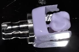 CEREC block zub e1487926146992