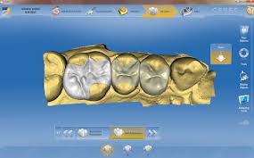 CEREC zuby2
